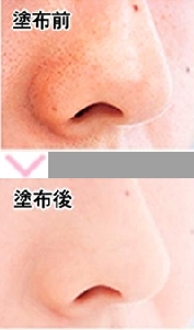 �ь��E���W�����u���ɃJ�o�[